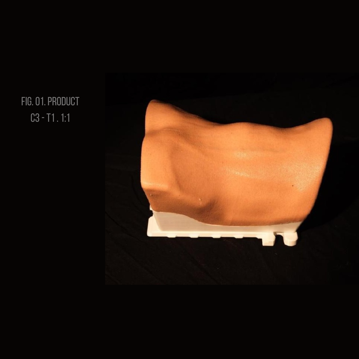 RealSpine Cervical Anterior